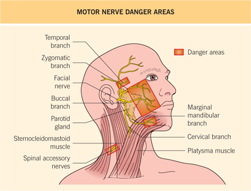 Motor Nerve Danger Zones