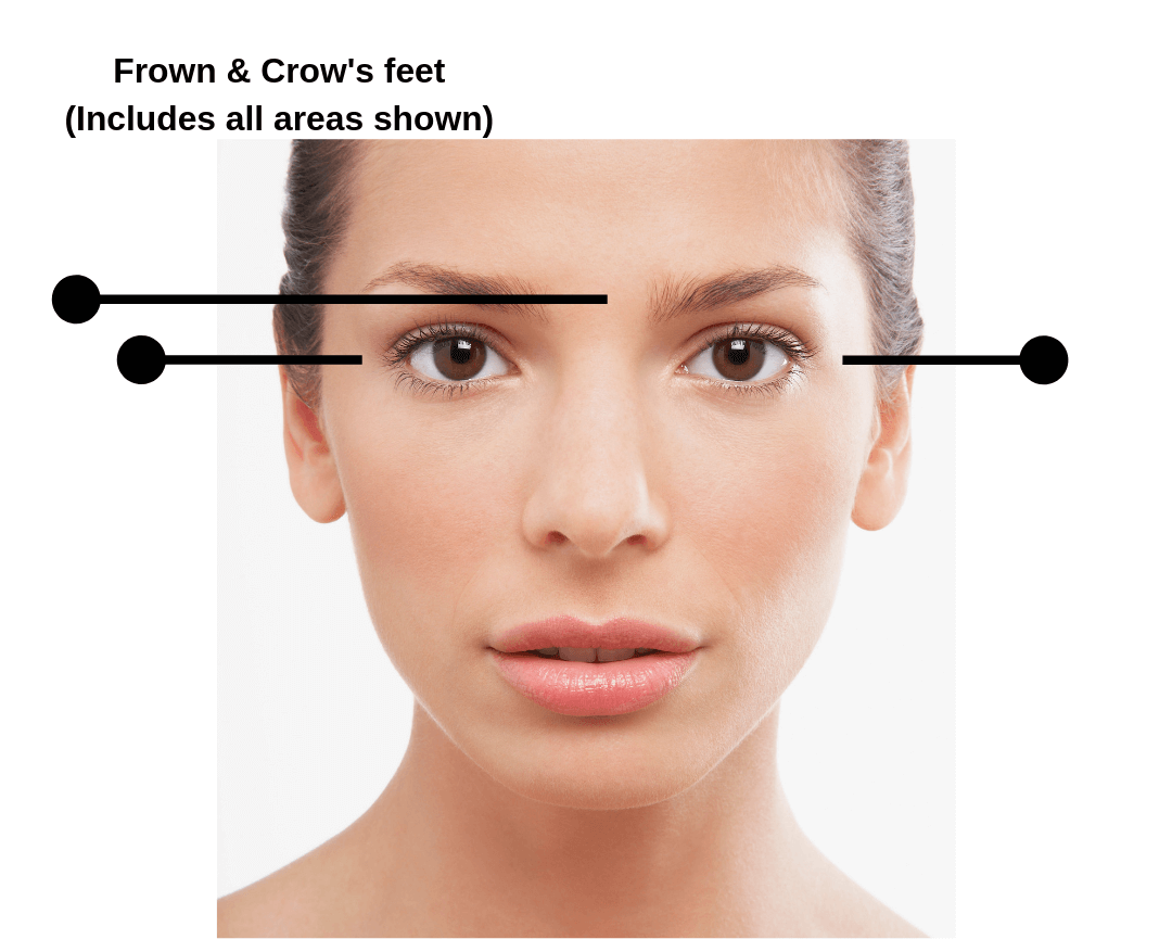 Botox Prices Frown and Crow’s Feet