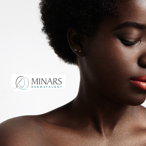 Hollywood, FL laser hair removal for dark skin