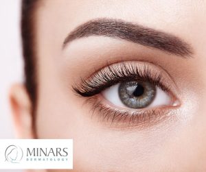 shingles rash eyes hollywood fl dermatologist minars dermatology