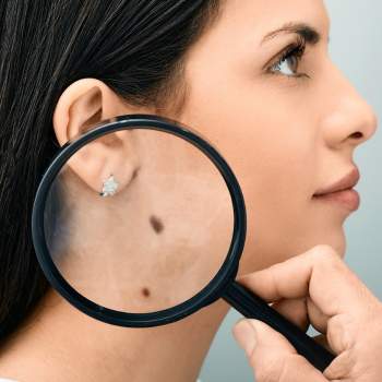 minars skin cancer screening hollywood florida cost dermatologist