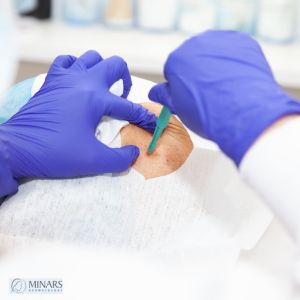 What to Expect If You Need a Skin Biopsy for Suspected Skin Cancer
