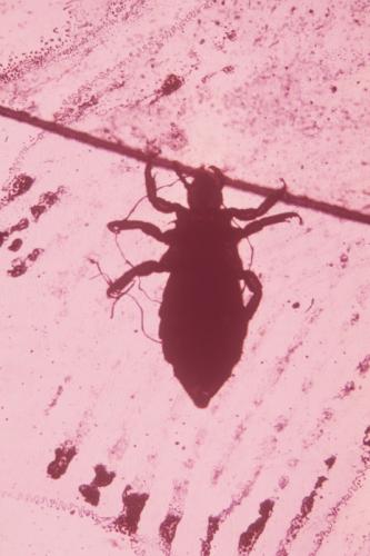 head lice